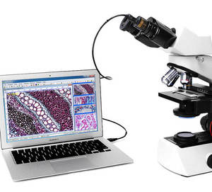 Caméra vidéo USB CCD, <span class=keywords><strong>microscope</strong></span> stéréo biologique, capture d'images, oculaire électronique industrielle avec 2 adaptateurs - Product Image 4