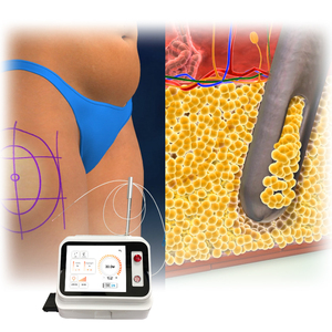 Lipólisis Avanzada con Fibra Óptica LAL de 1210nm para Eliminación de Grasa - Product Image 6