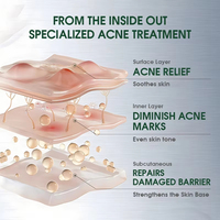 Crème Visage Personnalisée au Théier avec LOGO – Arbutine, Glycérine, Acide Salicylique, Acide Hyaluronique – Hydratante, Apaisante, Anti-Acné, Réparatrice Cutanée