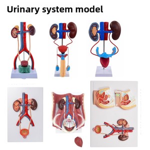 Modelo Anatómico de Riñón con Glándulas Adrenales Ampliadas, Riñones Patológicos, Anatomía Visceral Humana, Material PVC, MAXCARE MAC-L27 - Product Image 2