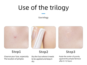 Parches Transparentes Hidrocoloides Invisibles de Gran Tamaño para el Acné, con Aceite de Árbol de Té, Tratamiento para Puntos y Manchas - Product Image 5