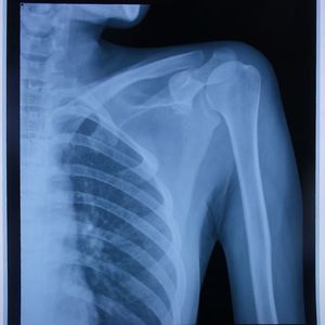 فيلم أشعة إكس أزرق ليزر نافث للحبر - Product Image 4