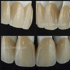 الأسنان إيماكس زركونيا تبييض الأسنان إيماكس وزركونيا القشرة مختبر الأسنان رخيصة الثمن - Product Image 4