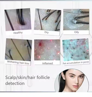 Microscope Smart 5G WiFi Dermascope sans fil Détecteur de scanner à quatre spectres Caméra de cheveux Service Oem Oem