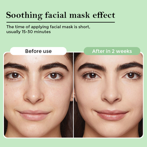 Acide salicylique Soins du visage <span class=keywords><strong>Meilleur</strong></span> <span class=keywords><strong>masque</strong></span> hydratant profond hyaluronique Exfoliant Hydratation Affiner les pores Produit pour la <span class=keywords><strong>peau</strong></span> - Product Image 4