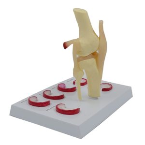 Modèle anatomique de l'articulation du genou avec ménisque pour l'enseignement médical, les études <span class=keywords><strong>cliniques</strong></span> et la communication médecin-patient avec CE - Product Image 4