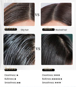 Oem/ODM nhãn hiệu riêng hữu cơ chăm sóc tóc, dầu gội đầu tự nhiên, số lượng lớn khách sạn tùy chỉnh Sulfate-Miễn phí gàu dầu gội đầu và điều hòa - Product Image 6