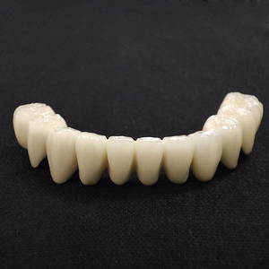 <span class=keywords><strong>Prix</strong></span> compétitif Fabrication dentaire <span class=keywords><strong>Dents</strong></span> <span class=keywords><strong>en</strong></span> <span class=keywords><strong>céramique</strong></span> métallique personnalisées avec gencive rose <span class=keywords><strong>en</strong></span> porcelaine - Product Image 3