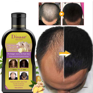 Shampooing Naturel au Gingembre pour la Croissance Capillaire, Hydratant et Anti-<span class=keywords><strong>Chute</strong></span>, pour Hommes et Femmes, Marque Privée - Product Image 2