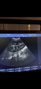 Ecógrafo Doppler Color Portátil Sonoscape E1EXPV para Diagnóstico Abdominal, Diagnóstico de Embarazo, Ultrasonido Veterinario para Uso Equino - Product Image 6