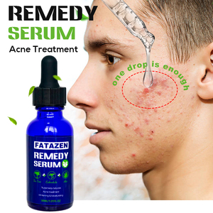 Private Label Natural Organic Remedy Serum trattamento per l'acne siero viso per la cura della pelle per siero Anti-età alla vitamina C al tè verde - Product Image 3