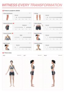 U + 300 Produtos De Fitness Inteligente Detecção De Gordura Muscular Bioimpedância Equilíbrio Bio Impedância Máquina 8 Ponto Muscular Obesidade Avaliação - Product Image 6