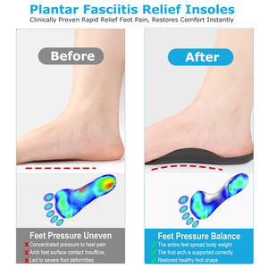 Plantaire Fasciitis Hoge Bogen Inlegzolen Boogsteun Orthetica Schoeninzetstukken Verlichting Voetpijn Platvoeten X/O Beencorrectie - Product Image 3