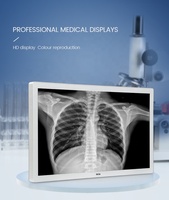 Écran médical professionnel 4K WLED de 27 pouces avec entrée/sortie DP, anti-reflet, blanc P270WUGA-SDI TKUN, pour bureau et salle d'opération