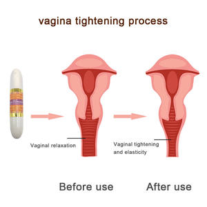 عصا يوني للنظافة النسائية، علامة تجارية خاصة، عشبية من مادورا، لتضييق المهبل وتنظيفه، ترطب وتقوي جدار المهبل - Product Image 4