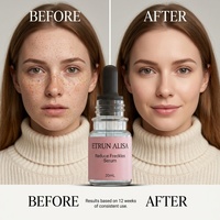 Sérum à la vitamine C en marque privée, soin de la peau toute la journée, anti-rides, éliminateur de taches brunes, sérum éclaircissant pour peau noire