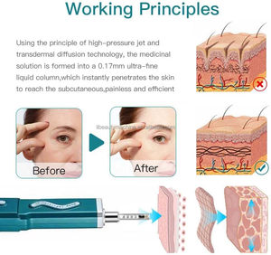 Lápiz Hialurónico para Rejuvenecimiento de la Piel con Mesoterapia, Sin Agujas, Forma Líquida para Labios, Inyección sin Agujas, Ampolla de 0.5ml - Product Image 6