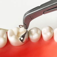 Bandes matricielles sectionnelles de soins dentaires 50 pièces/boîte avec des tailles de 3.5mm 4.5mm 5.5mm 6.5mm