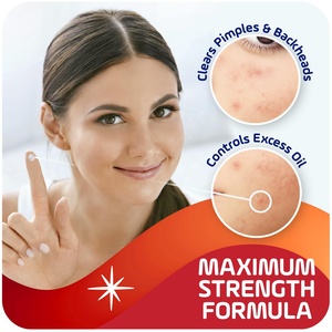 Crème anti-imperfections et acné à l'acide salicylique 2%, Soin apaisant <span class=keywords><strong>pour</strong></span> peaux irritées, Gel anti-acné jour et nuit - Product Image 4