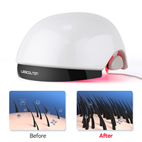 Casque de Croissance Capillaire Lescolton 162 Diodes, Appareil Portable de Thérapie Laser Contre la Chute des Cheveux, Casque de Repousse Capillaire à Lumière Rouge