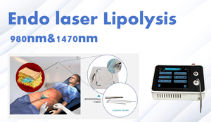 Bbl simming פנים sendolaser 1470nm 980nm סיב קנולות ליפולזה הזרקת פלזמה פליפוזיציה - Product Image 2