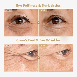 Siero Contorno <span class=keywords><strong>Occhi</strong></span> Ginseng Plus con Retinale, Niacinamide e Bakuchiol per Correzione di <span class=keywords><strong>Borse</strong></span> Sotto gli <span class=keywords><strong>Occhi</strong></span>, Linee Sottili, Occhiaie e Rughe - Product Image 2