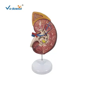 Kidney with Adrenal Gland, 3X life size anatomical medical models