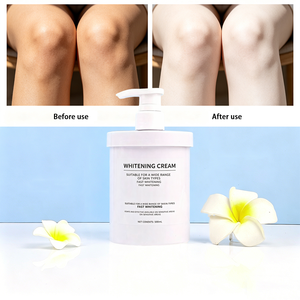 Fórmula Avanzada Aclarante: Loción Hidratante con 4% de Arbutina + Vitamina C + Niacinamida para la Corrección de la Hiperpigmentación - Product Image 1