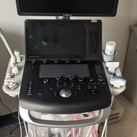Échographe portable d'occasion Versana Premier avec technologie Doppler couleur