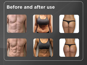 ADSS EMS Elektromagnetisches Muskelaufbau- und Körperformungsgerät EMS Po-Lifting-Maschine für Gewerbliche Salons - Product Image 6