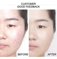 Fond de teint mat liquide OEM personnalisé en gros étiquette blanche prix raisonnable correcteur de visage pour la peau foncée sans huile aspect naturel