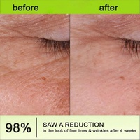 Sérum pour les yeux au rétinol en marque privée OEM, anti-âge, réparation des rides, raffermissant, élimination des cernes, soin hydratant pour les yeux