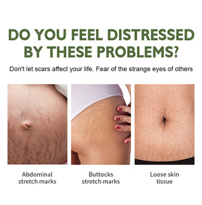 Crema Riparatrice Naturale di Alta Qualità per Smagliature e Cicatrici da Acne, Crema per Rassodare la Pancia - Product Image 3