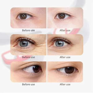 Masseur oculaire à lumière rouge personnalisé avec logo, compresse chaude, anti-rides, élimination des cernes, appareil de beauté pour les yeux 3D - Product Image 6