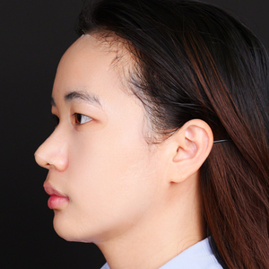 BEIHAO ODM/OBM Hydraterende, herstellende, verhelderende, anti-verouderings gezichtsmasker zonder parabenen met hyaluronzuur |   Directe levering voor iedereen - Product Image 2