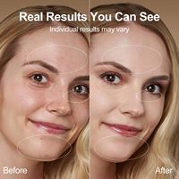 Appareil de beauté pour le cou à micro-courant, portable, rechargeable, raffermissant la peau, anti-âge, lissant les ridules, outil de soin à domicile