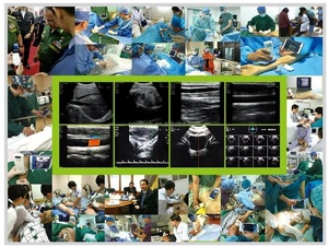 B26E Sonde à ultrasons sans fil 3 en 1 portable à haut coût - Product Image 3