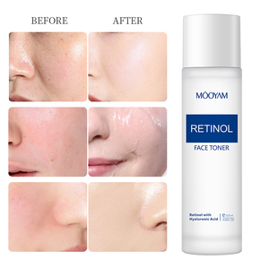 Tonique Visage MOOYAM Végan Éclaircissant au Rétinol, Vitamine C et Acide Hyaluronique – Hydratant, Régénérant et Antioxydant en Marque Privée - Product Image 6