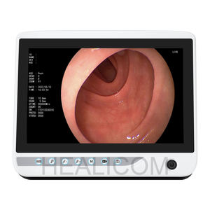 10インチディスプレイポータブル獣医内視鏡システム120 ° ワイドビュー軽量デザイン - Product Image 3