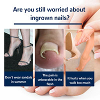 Autocollants de correction des ongles et patchs de soin pour l'art des ongles, baume pour les ongles incarnés du pied