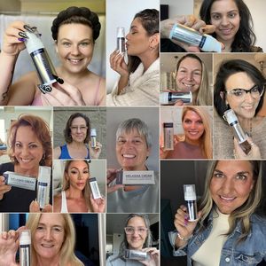 Aloe Vera kem cho điều trị nám tuổi tại chỗ Loại bỏ da đổi màu sau vết sẹo vết sẹo điểm mặt cơ thể đốm đen - Product Image 6