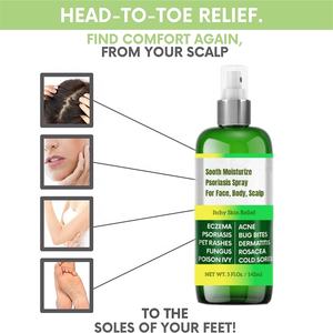 Eczema-tratamiento <span class=keywords><strong>para</strong></span> la Psoriasis, antipicazón espray hidratante <span class=keywords><strong>para</strong></span> el acné, <span class=keywords><strong>Dermatitis</strong></span>, sacea, alivio del cuero cabelludo <span class=keywords><strong>para</strong></span> niños y adultos - Product Image 2