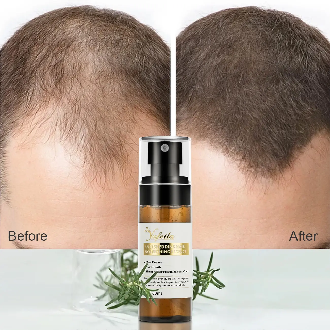 Personalización profesional 60ml Spray de crecimiento con aceite de ricino e ingredientes de vitamina E aerosol de suero para el crecimiento del cabello