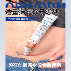 Gel OEM para la reparación de cicatrices posparto 15g para mujeres, crema corporal para el cuidado de cesáreas, prevención y reparación de estrías - Product Image 2