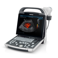 Machine à ultrasons numérique portable Mindray DP-30 Vet Scanner d'imagerie diagnostique vétérinaire noir et blanc