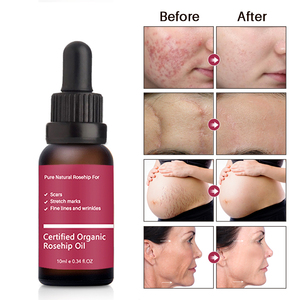 Aceite antioxidante de rosa mosqueta orgánico, utilizado para tratar líneas finas, arrugas y mejorar la elasticidad de la piel - Product Image 5