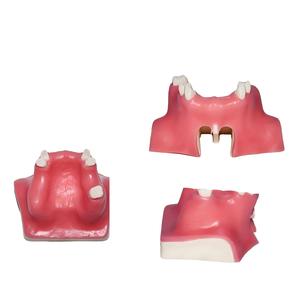 Modelo de Entrenamiento para Levantamiento de Seno Maxilar - Modelo de Práctica de Seno Maxilar Tipo C para Educación Dental - Product Image 2