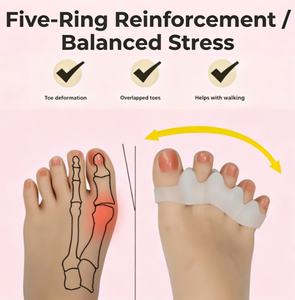 Separadores de Dedos Pequeños para Adultos y Niños, Dispositivo Ortopédico para Aliviar el Dolor de Pies y Enderezar la Deformidad del Hallux, Venta Directa de Fábrica - Product Image 4