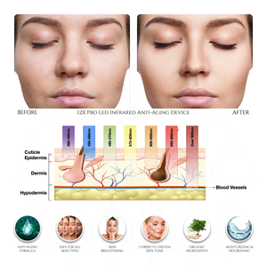 Masseur facial chaud et froid, <span class=keywords><strong>appareil</strong></span> de soin de la peau, instrument de beauté à vibration sonique, nettoyage en profondeur des pores, absorption des nutriments - Product Image 2