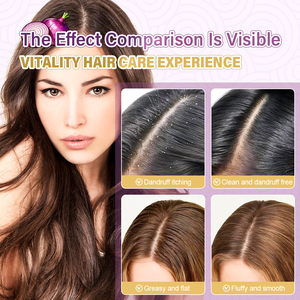 Champú al por mayor de cebolla roja y aceite de semilla negra 150ml con limpieza profunda, anticaspa, control de grasa e hidratación para el cuero cabelludo - Product Image 6